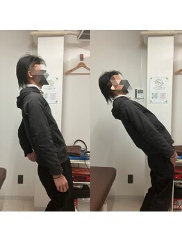 とるこり美姿整体院 新宿院/20代男性-腰痛改善Before/After