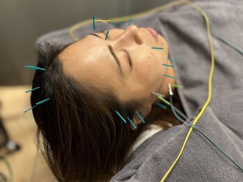 ラナスサッポロ(RUNUS SAPPORO)の写真/【視界の明るさと目の開きに変化が…!】辛い疲れ目も"パッと視界が広がる"感覚に☆食いしばりの改善にも◎