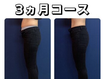 久留米スポーツ整骨院 整体院/エステ◆痩身インディバエステ