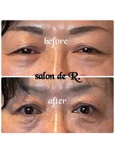 サロン ド アール(salon de R.)/【小顔骨氣・50代・お目元効果】