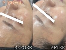 レイネ(REINE)/韓国ララピール