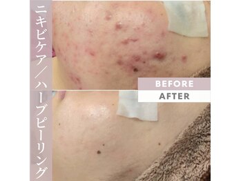 アナシアビューティーサロン(Anacia)