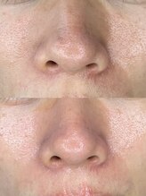 エイト アイ(8 eye)/憧れのノーファンデ肌へ