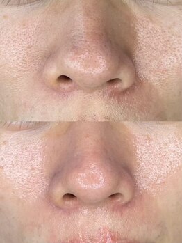 エイト アイ(8 eye)/憧れのノーファンデ肌へ