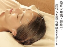 頭皮鍼と前額部の鍼◎首肩こり・頭痛・目の疲れ・睡眠改善にも