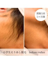 ココスターリー 大橋店(Coco starry)/