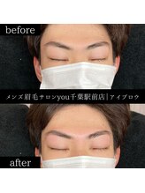 ユー 千葉駅前店(you)/ビフォ－アフター写真