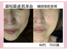 シェリー トウキョウ 西葛西店(Cherie Tokyo)の雰囲気（年齢に囚われない肌作りを証明致します。）