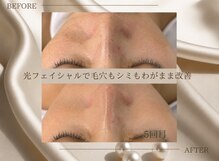 サロン ド ビューティージュエル(salon de beauty JEWEL)