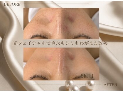 サロン ド ビューティージュエル(salon de beauty JEWEL)の写真