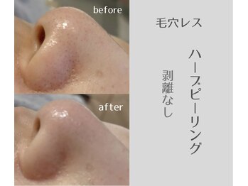 アールエスト(R EST.)の写真/【結果重視】毛穴レス艶肌☆オールハンド施術で毛穴、たるみ、シワ、シミのない極上のハリツヤ肌に!