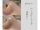 アールエスト(R EST.)の写真/【結果重視】毛穴レス艶肌☆オールハンド施術で毛穴、たるみ、シワ、シミのない極上のハリツヤ肌に!