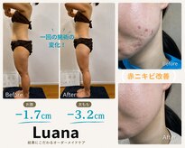 ルアナ(Luana)