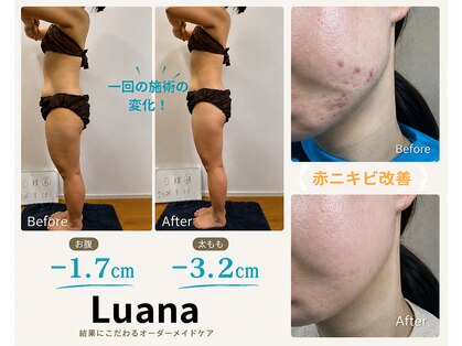 ルアナ(Luana)の写真