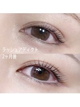 ネイル&アイラッシュ ルミア(Nail & Eyelash LUMIA)/～LumiA～ フォトギャラリー