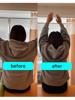 朱雀整骨院/痛みにも強いです！