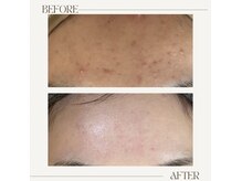 アンド(&.)/before/after