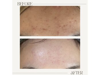 アンド(&.)/before/after