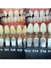 トウキョウスワーズ 池袋店(TOKYO SWRS)/#ホワイトニング #池袋 #渋谷