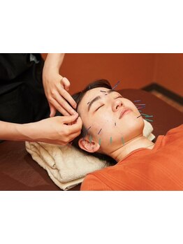 鍼灸施術を受けたい