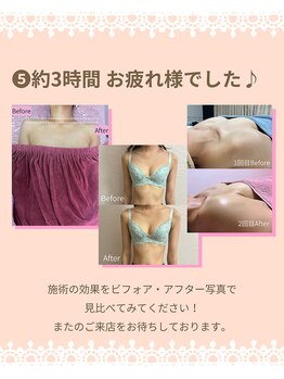 チュラ 大宮店(Chura)/バストアップ施術の流れ(6/6)