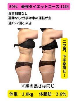 ヨサパーク ルアナ 高島店(YOSA PARK Luana)/50代体を温めれば年齢は関係なし