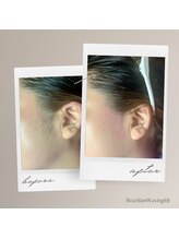 ブラジリアンワキシング シックスナイン(BrazilianWaxing69)/女性 / もみあげ