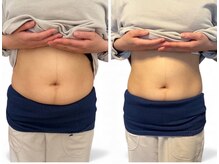 チチ(Chichi)/ウエストダウン