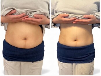 チチ(Chichi)/ウエストダウン