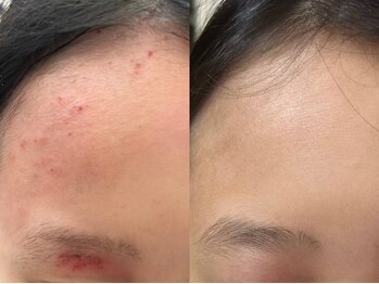 ライブリー(LIVELY)/