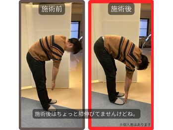 まこと整骨院/ぎっくりな腰でもこれだけ変化２