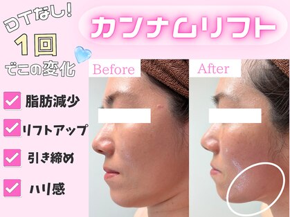 モテキ 表参道店(MoTeKi)の写真