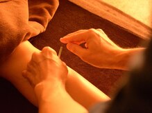 鍼灸師 かわなみこうき/痛みに弱い方にもオススメの鍼灸