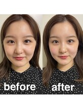 マホロバ(mahoroba)/美容鍼＋頭皮鍼