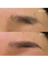 ハービンドール/【HBL】