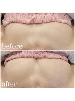 サチ(Sachi)/54歳年バストの下垂に悩む日々