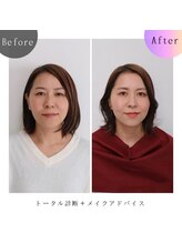 シュアリー(Surely)/トータルコースお客様事例