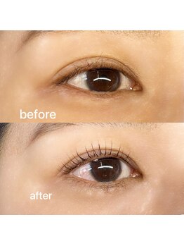 マール(mar)/ラッシュリフト　