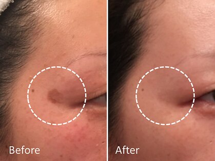 リベラ(Libera)の写真