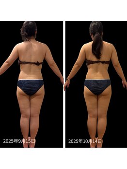 クールヴィラ(Cool Villa)/