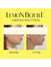 【モニター限定】韓国美容レモンボトルで即日スッキリ小顔へ◎2cc 45分×3回
