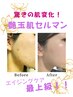 【エイジングケア最上級】艶玉肌セルマン　 驚くほどの肌変化を実感！15400円