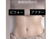 ソラ 菊陽光の森(SOLA+)/お腹集中！