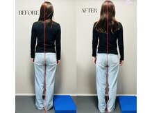 春日整体院ito/【姿勢改善ビフォーアフター】