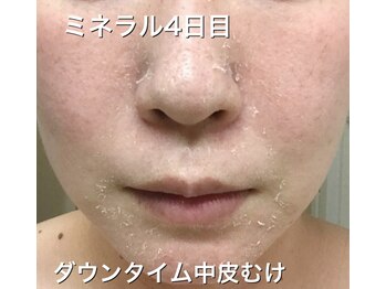 リラクゼーションサロン カネサチ/ミネラルトリートメント