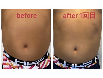 ビューティーサロン リリー(Lily)/