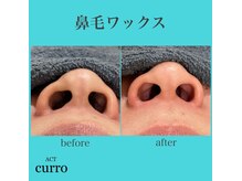 アクト クロ(ACT curro)/【鼻毛ワックス】施術例