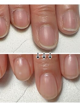 スマイルニコ(smile nico)/ピンクの部分を伸ばす