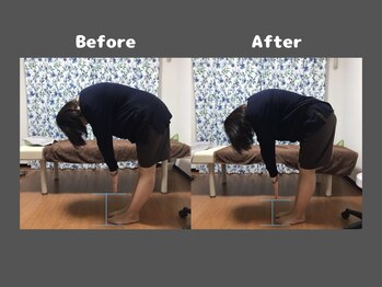 くにたちNyan鍼灸整体院/【整体】Before After 3