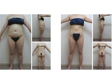 Nビューティー/最新エンダモロジーBODY